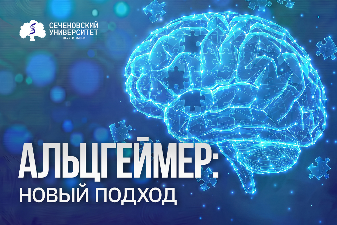 Инновационный метод лечения пациентов с болезнью Альцгеймера предложили в Сеченовском Университете