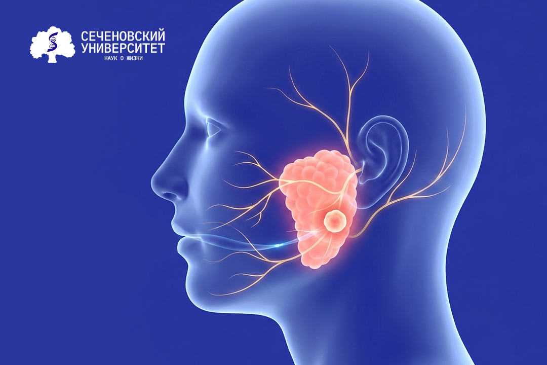 В Сеченовском Университете разрабатывают тест для диагностики опухолей околоушной слюнной железы  