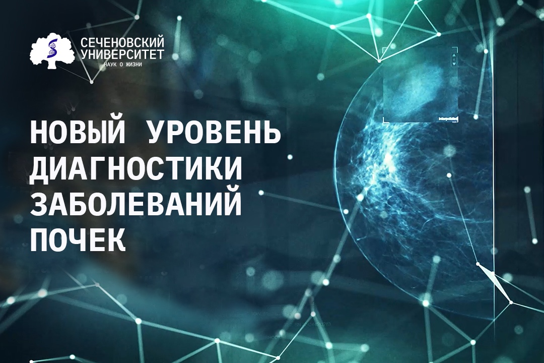 ИИ Сеченовского Университета и Билайна вывел диагностику заболеваний почек на новый уровень