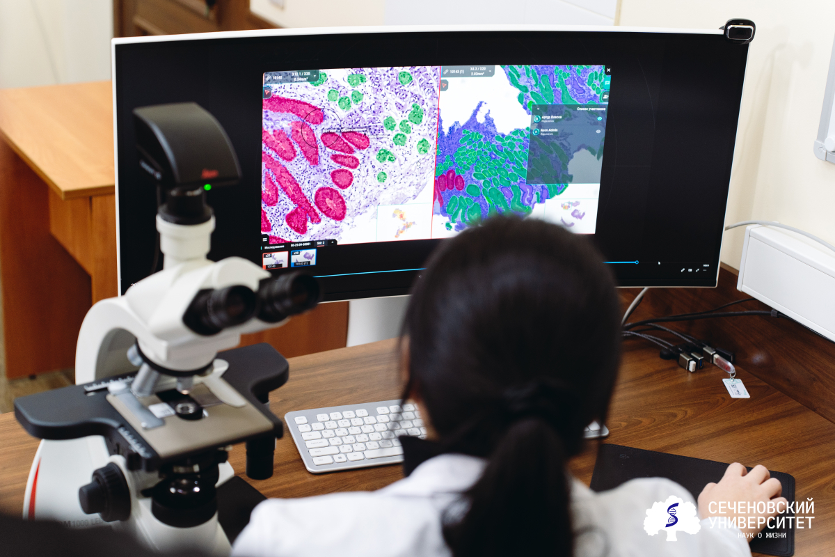 Специалисты Сеченовского Университета и Билайна Big Data & AI разработали уникальный алгоритм для диагностики предракового гастрита