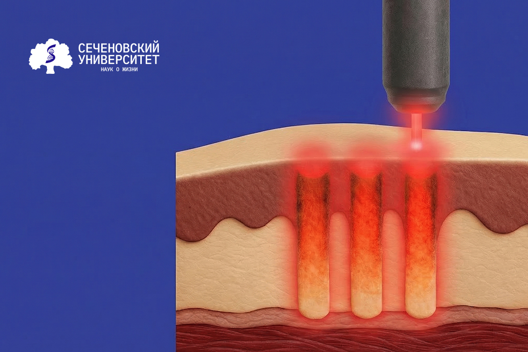 Ученые Сеченовского Университета и РУДН нашли способ запустить регенерацию десны с помощью лазера