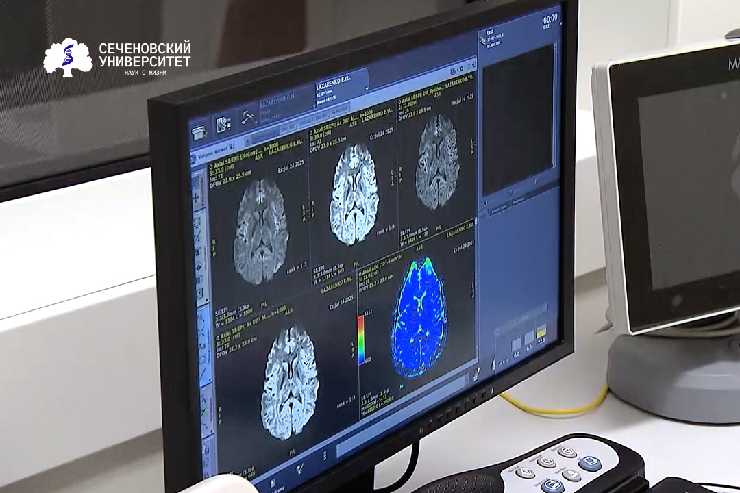 Телеканал «Россия 24» продолжает серию передач об уникальных разработках и технологиях Сеченовского Университета