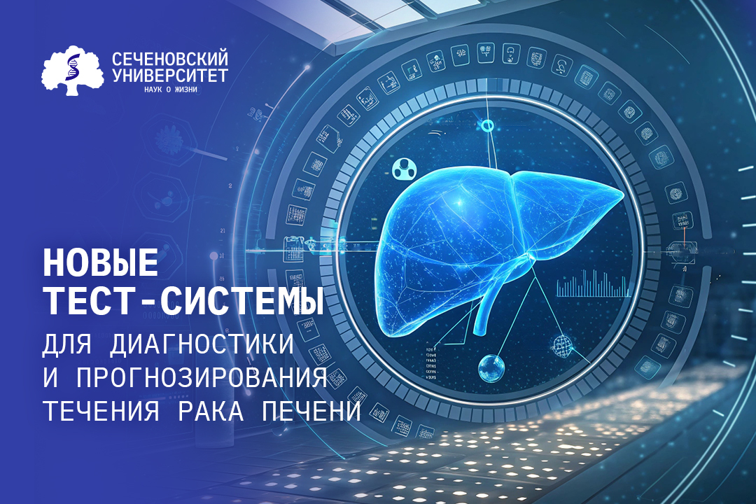 В Сеченовском Университете создадут тест-системы для прогнозирования течения рака печени