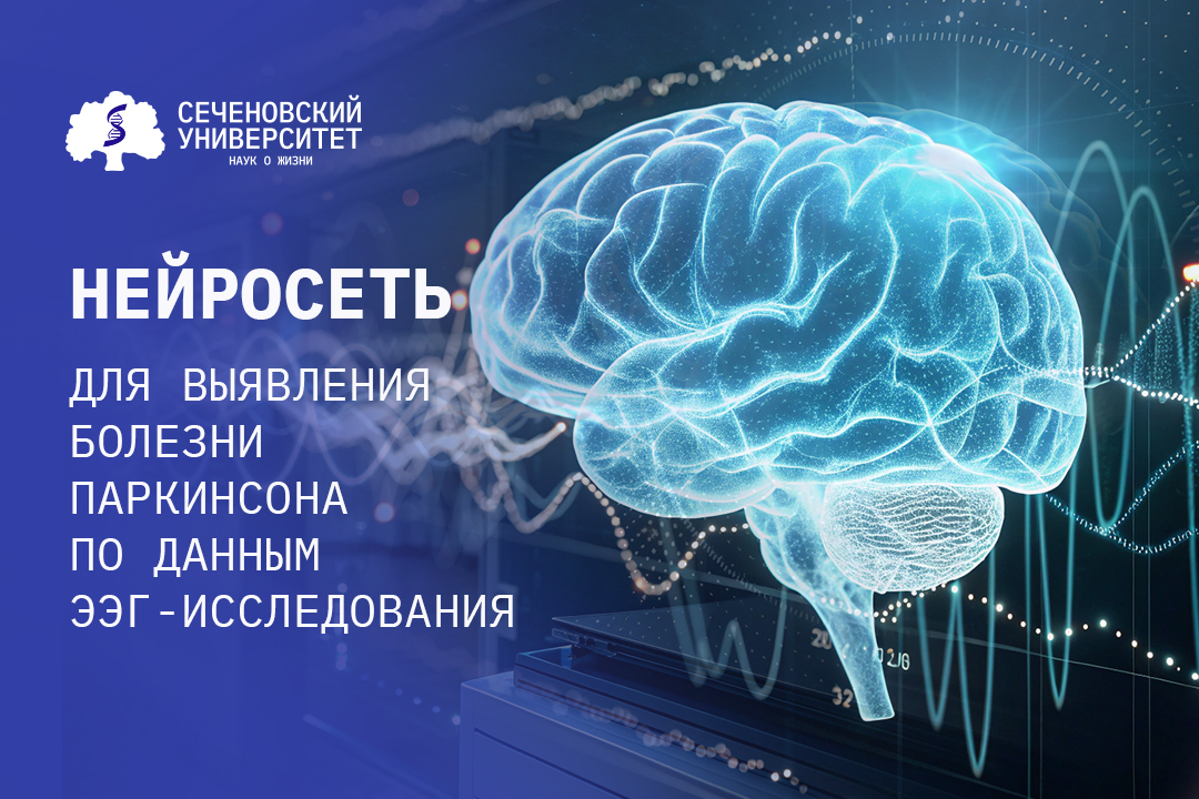 В Сеченовском Университете разработали нейросеть для выявления болезни Паркинсона по данным ЭЭГ-исследования