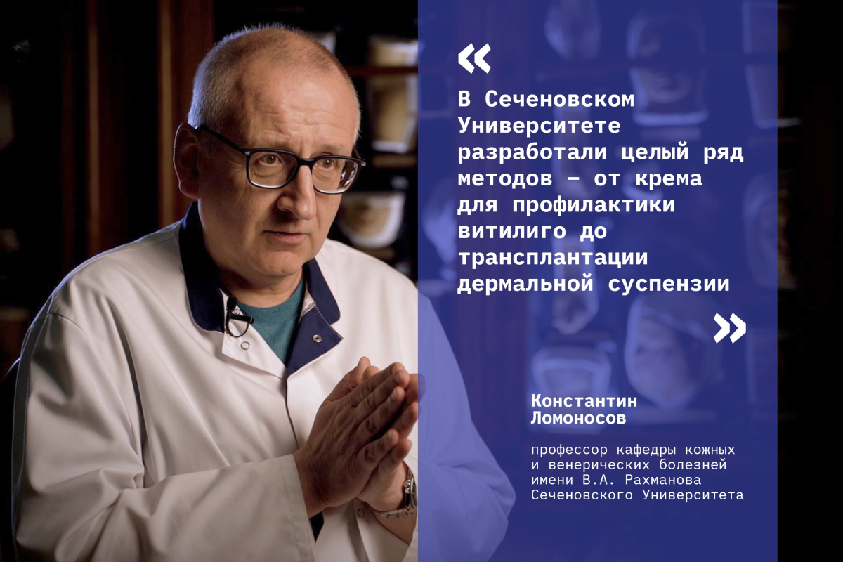 От крема до трансплантации: в Сеченовском Университете изобрели новые методы лечения витилиго