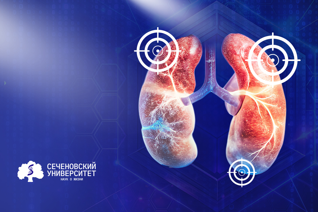 Ученые Сеченовского Университета предложили новый взгляд на классификацию рака почки с помощью искусственного интеллекта