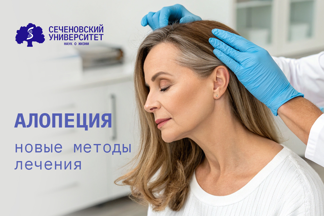 В Сеченовском Университете применили новые методы лечения алопеции